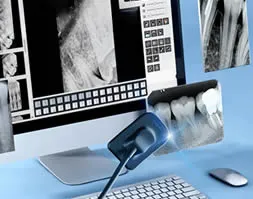 digital-x-rays