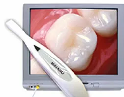 intra-oral-camera